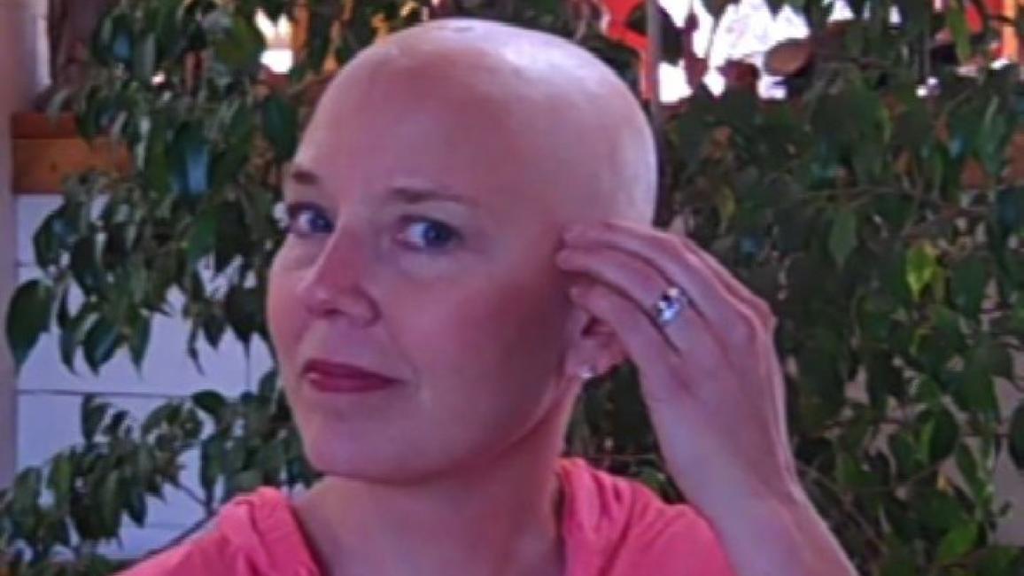 Best Friends CEO Julie Castle after she had lost her hair